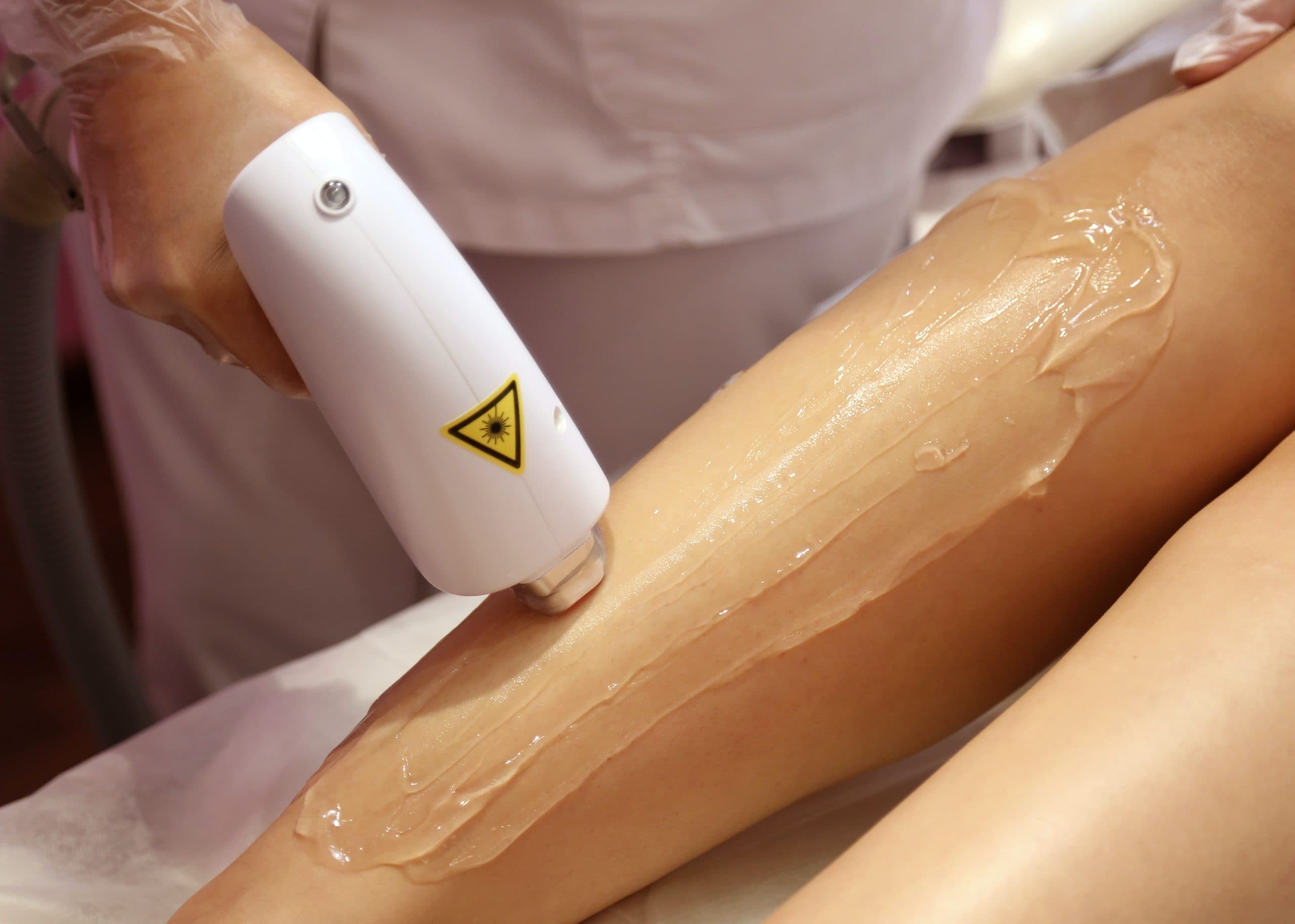 A laser hair removal handpiece passing over a leg prepared with conductive gel